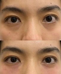 -郡艺医疗美容·微整·眼鼻吸脂