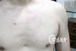 -雲艺刺青·洗纹身