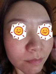 体验后-美莱医学美容医院