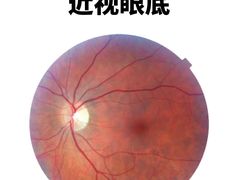 -诺柯视眼镜-蔡司依视路官方工厂店(淞南一店)