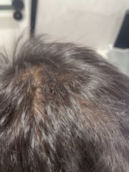 -熙朵美学植发·连锁品牌