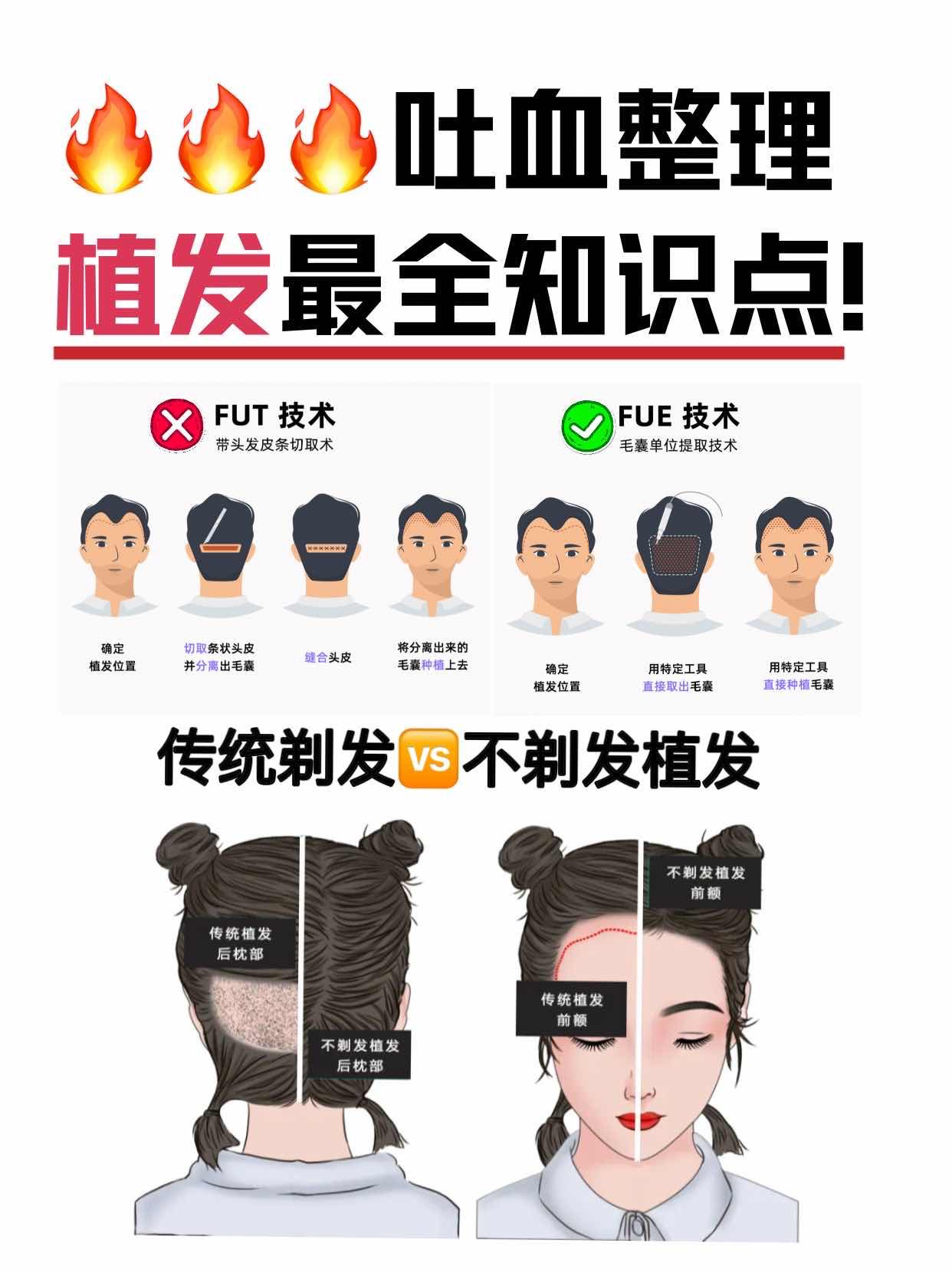 性价比高植发(植发那个品牌好)