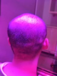 -熙朵美学植发·连锁品牌