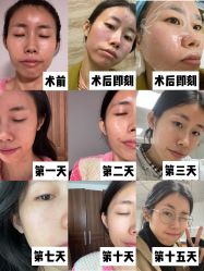 -海峡医疗美容医院