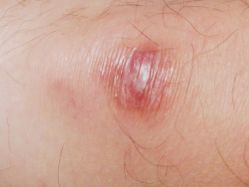 -成都军建医院·疤痕诊疗中心