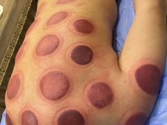 -理疗君·古法推拿姜疗SPA馆(东门店)