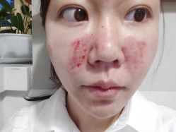 -空军总医院激光整形美容中心