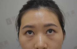 -天津健丽·去眼袋医疗美容机构