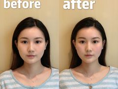 -FACE·日本小颜美容整骨(福田店)