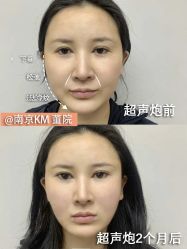 点击看大图 -南京康美美容医院·旗舰店