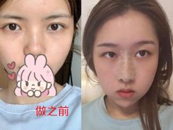 -东莞缔美美容医院