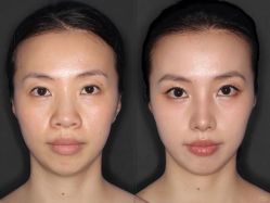 -上海伊莱美医疗美容医院