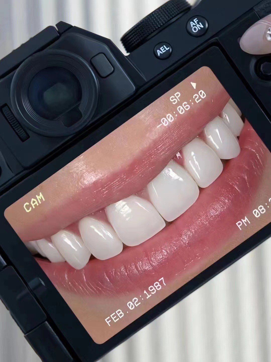 亮白牙齿自然闪耀