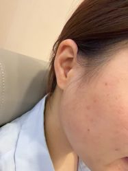 -长沙雅美医疗美容医院