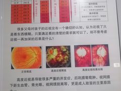 -苏州大学理想眼科医院