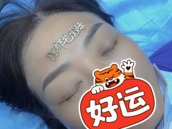体验后-郡艺医疗美容·微整·眼鼻吸脂