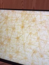 点击看大图 -东森自然美.INDIBA.美容SPA.皮肤管理