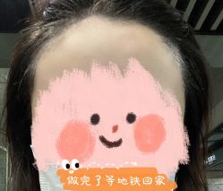 点击看大图 -西施无菌半永久纹绣眉眼影唇轻增发纹发际线