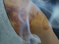 -悦和堂中医门诊部·疼痛调理·针灸推拿·艾灸拔罐