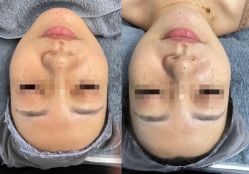 体验前-来美轻医美抗衰中心