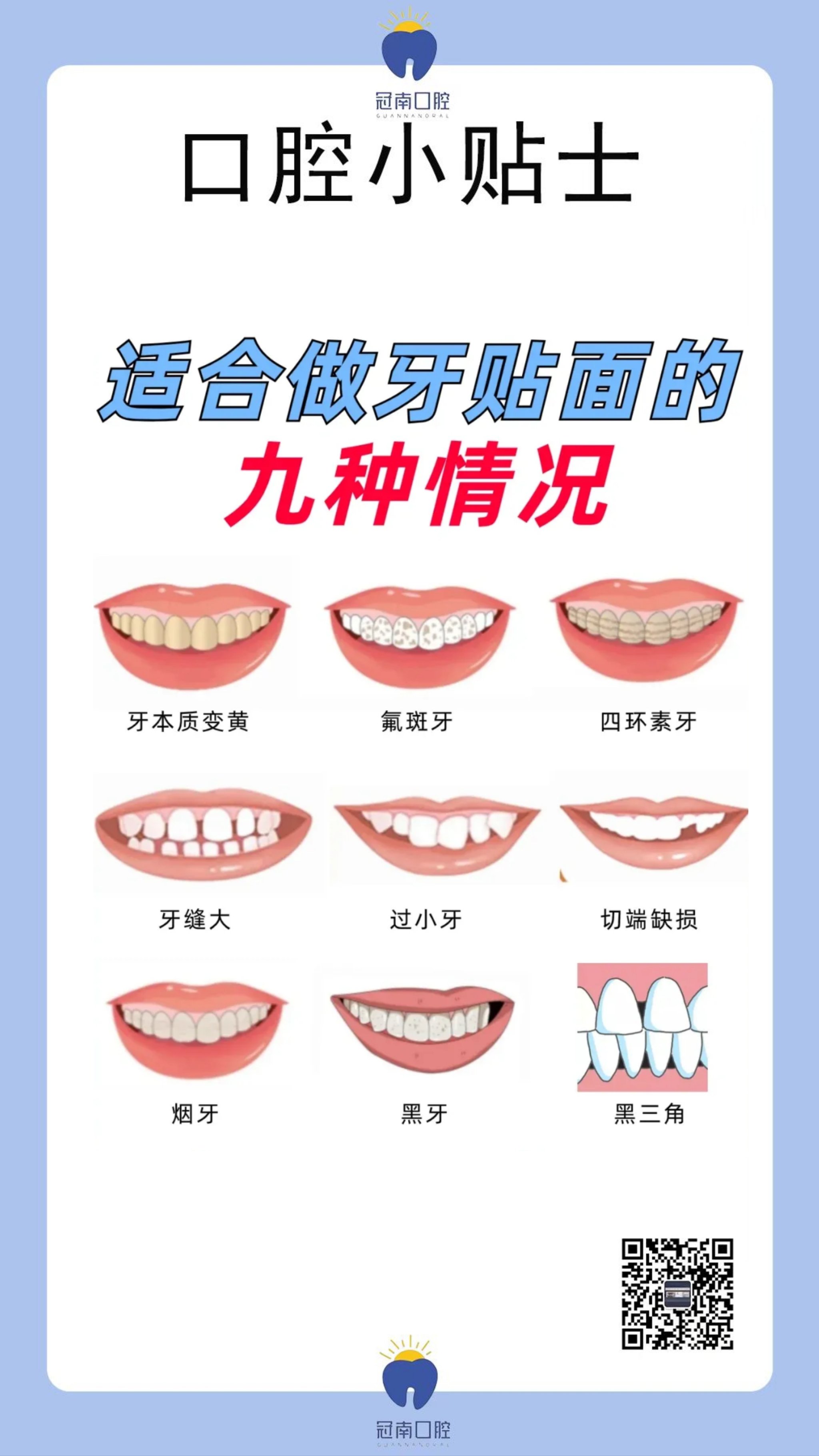 适合做牙贴面的九种情况,快来看你是吗?牙黄?