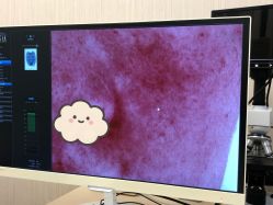 体验前-韩国淼美颜皮肤管理官方直营店