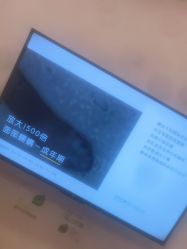 -塑青春&伊肤泉祛痘皮肤管理