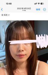 -亿美医疗美容·半岛大超炮官方授权店