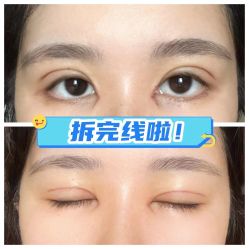 -素美医疗美容·西南眼鼻整形·修复基地