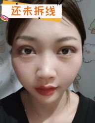 -素美医疗美容·西南眼鼻整形·修复基地