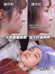 -美瑞莎创美医疗美容