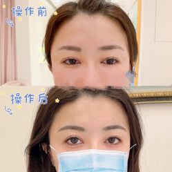 -UP&UP·半永久眉毛眼线机器野生眉