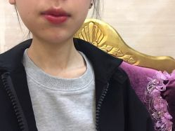 点击看大图 -禾美嘉医疗美容