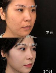 -北京米扬丽格医疗美容·联合丽格鼻整形中心