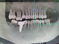 -诺贝尔一诺口腔医院(雁塔院区)