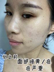 -新美荟医美·专注面部美学抗衰