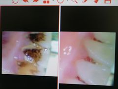 -合肥美奥口腔·种植矫正中心(政务院)