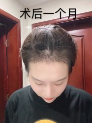 -雍禾植发全国连锁