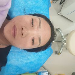 -海涛医疗美容·面部抗衰·注射美鼻