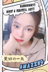 点击看大图 体验后-大麦微针植发全国连锁