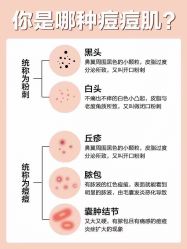 点击看大图 -美肤盾祛痘·问题肌头疗管理中心