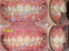 -岳辰齿科(浦东长泰店)