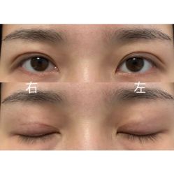 -西安壹加壹医疗美容·西北抗衰旗舰店