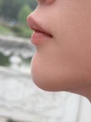 -郡艺医疗美容·微整·眼鼻吸脂