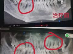 -同步齿科·数字化正畸种植口腔中心(珠海店)