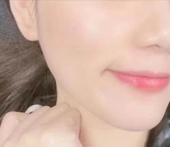 体验后-西安现代妇产医院医疗美容