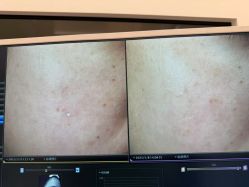 -苑苑vbeauty科技美容SPA