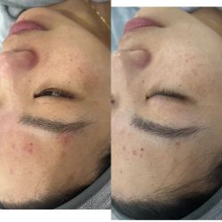 点击看大图 -SKIN79皮肤管理中心
