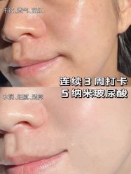 -安吉拉青春化管理中心