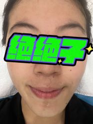 点击看大图 体验后-坤如玛丽·医疗美容中心